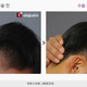 Image for article titled "Round Head" Plastic Surgery Seems Excessive, Even for South Korea
